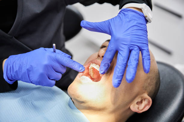 Best Emergency Dental Care for Abscessed Tooth in Burkesville, KY